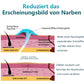 Bioskin™100% Fortschrittliches Narbengel - Kaiserschnitt, Bauchdeckenstraffung, alte Narben, Keloide, Dehnungsstreifen, Brandnarben