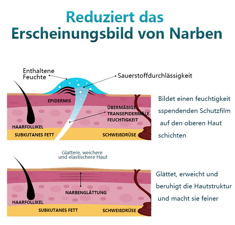 Bioskin™100% Fortschrittliches Narbengel - Kaiserschnitt, Bauchdeckenstraffung, alte Narben, Keloide, Dehnungsstreifen, Brandnarben