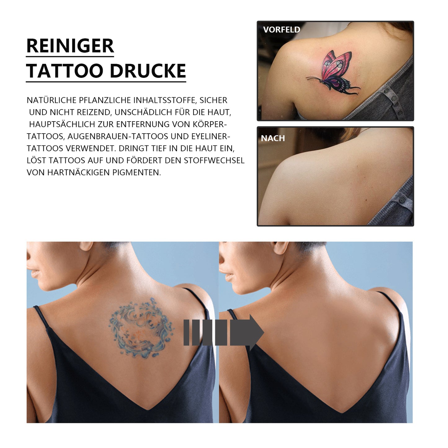 Nr. 1 InkVanish™Tattoo-Reinigungslösung 2023