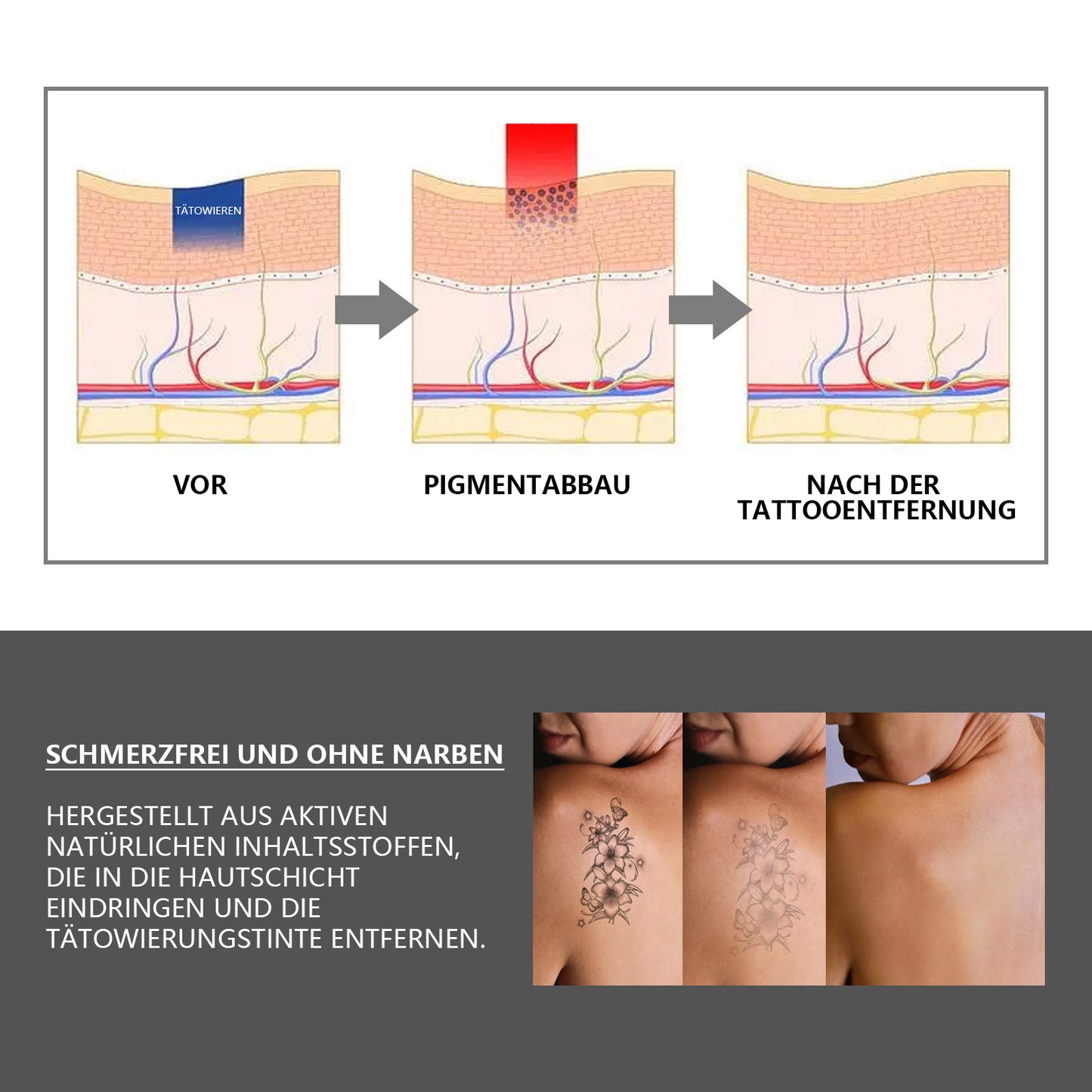 Nr. 1 InkVanish™Tattoo-Reinigungslösung 2023