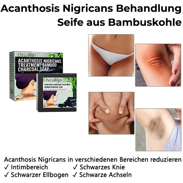 Oveallgo™ Acanthosis Nigricans Behandlung Seife aus Bambuskohle