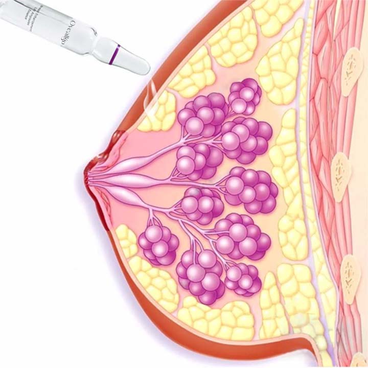 Oveallgo™ Lifting-Ampullenöl zur Brustvergrößerung