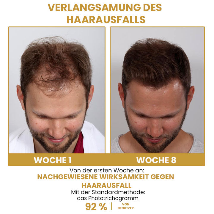 Oveallgo™ CaffeineGRO Haar & Bart Serum Spray