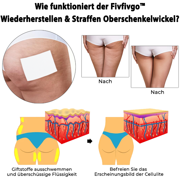 Oveallgo™ PaeoniaPRO  Wiederherstellen & Straffen Oberschenkelwickel