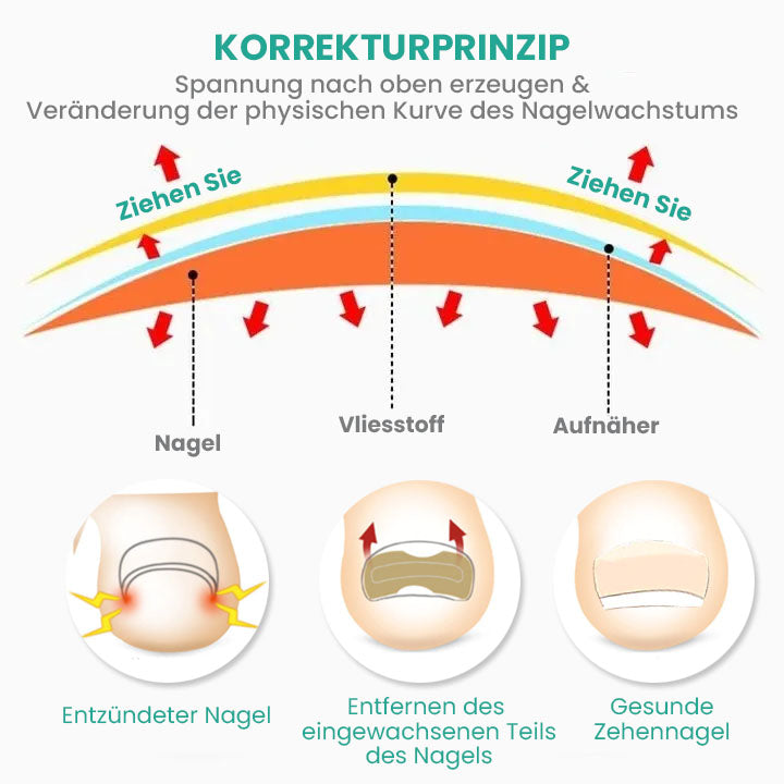 German HealExpert Paronychie-Linderungspflaster