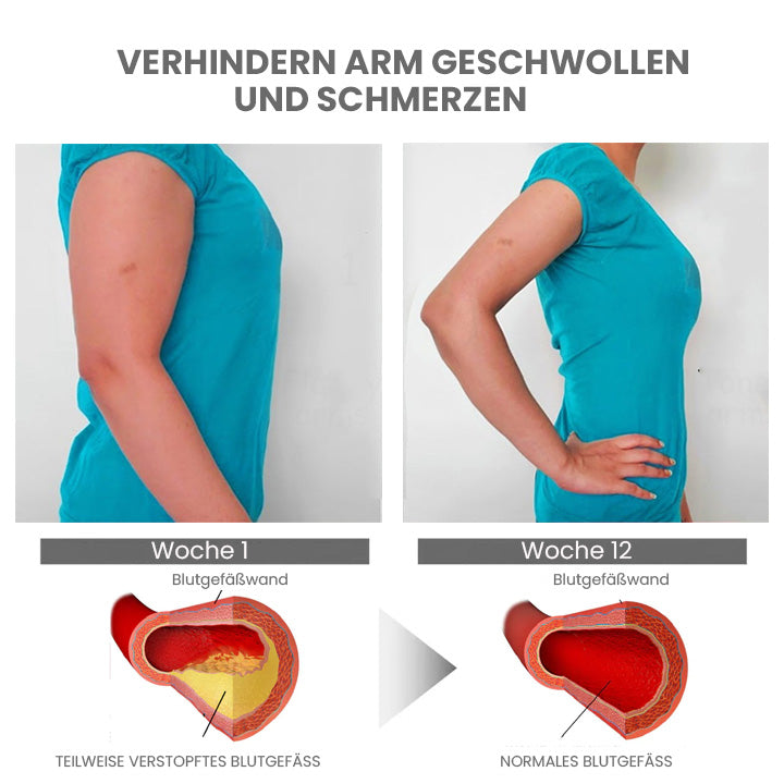 GooLivingUltra Anti-Höcker Lymphpflege Ingwer Salbe