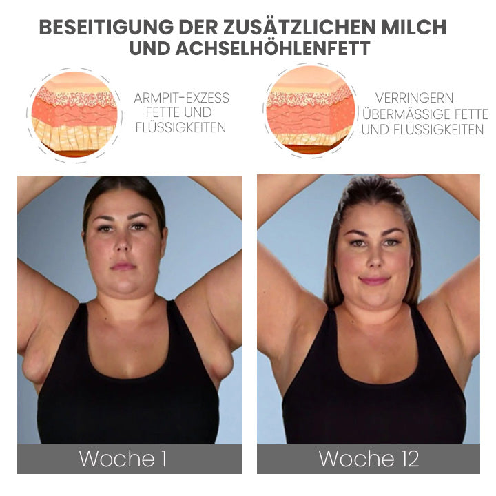 GooLivingUltra Anti-Höcker Lymphpflege Ingwer Salbe