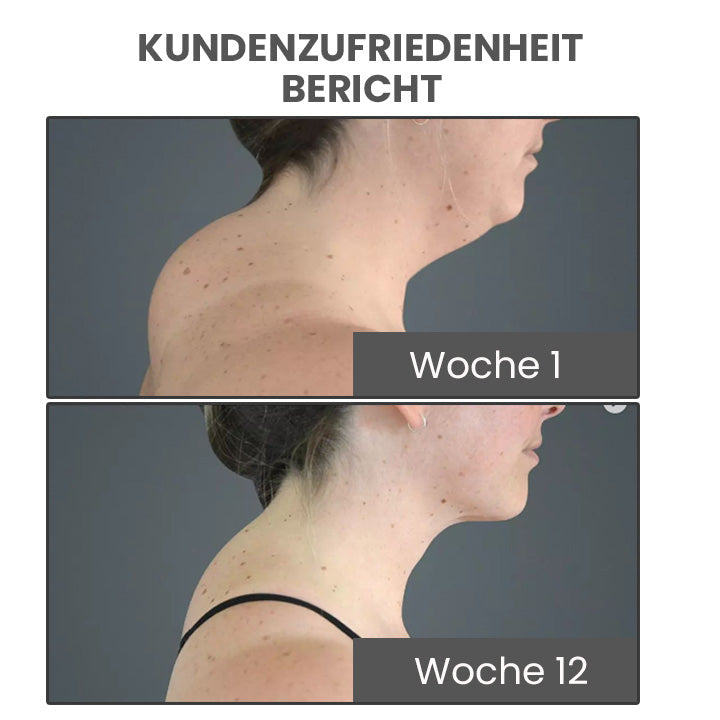 GooLivingUltra Anti-Höcker Lymphpflege Ingwer Salbe