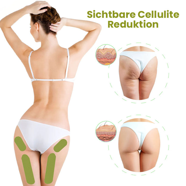 Oveallgo™ HerbalFirm PURI Cellulite Reduktion Pflaster