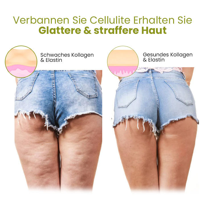 Oveallgo™ HerbalFirm Wunder Cellulite Reduktion Pflaster