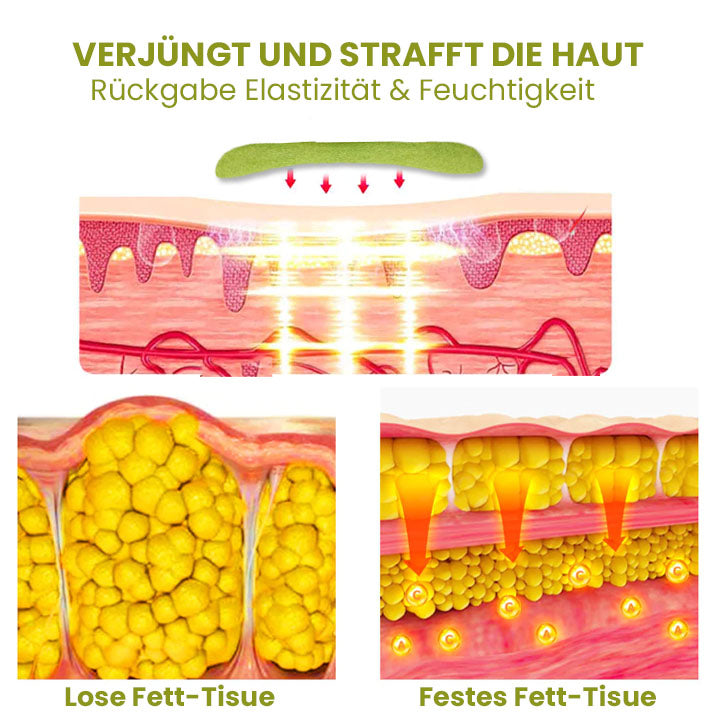 Oveallgo™ HerbalFirm Wunder Cellulite Reduktion Pflaster