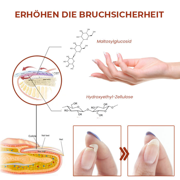 Oveallgo™ 7 Tage PURI Maximale Stärke Nagel-Reparatur-Serum