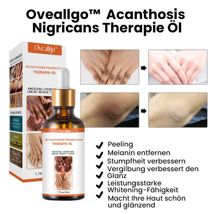 Oveallgo™ Akanthose Nigricans Therapieöl