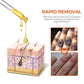Oveallgo™ Akanthose LUX Nigricans Therapieöl
