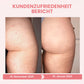 Oveallgo™ BootyBoost Ultimativ AntiAkne Peeling Natürliche Seife