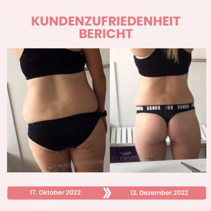 Oveallgo™ BootyBoost AntiAkne Peeling Natürliche Seife