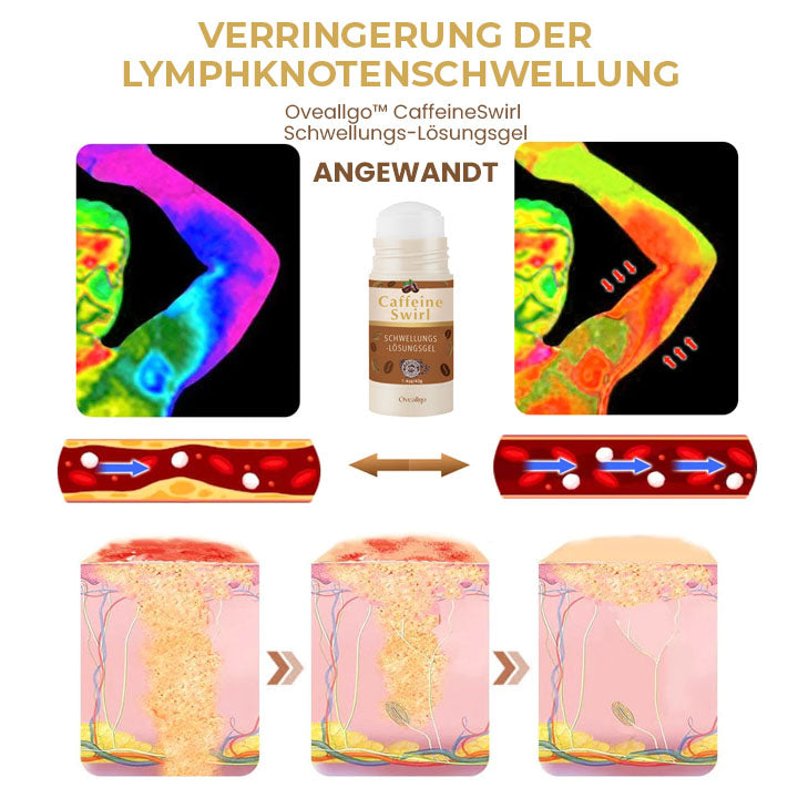 Oveallgo™ CaffeineSwirl Schwellungs-Lösungsgel