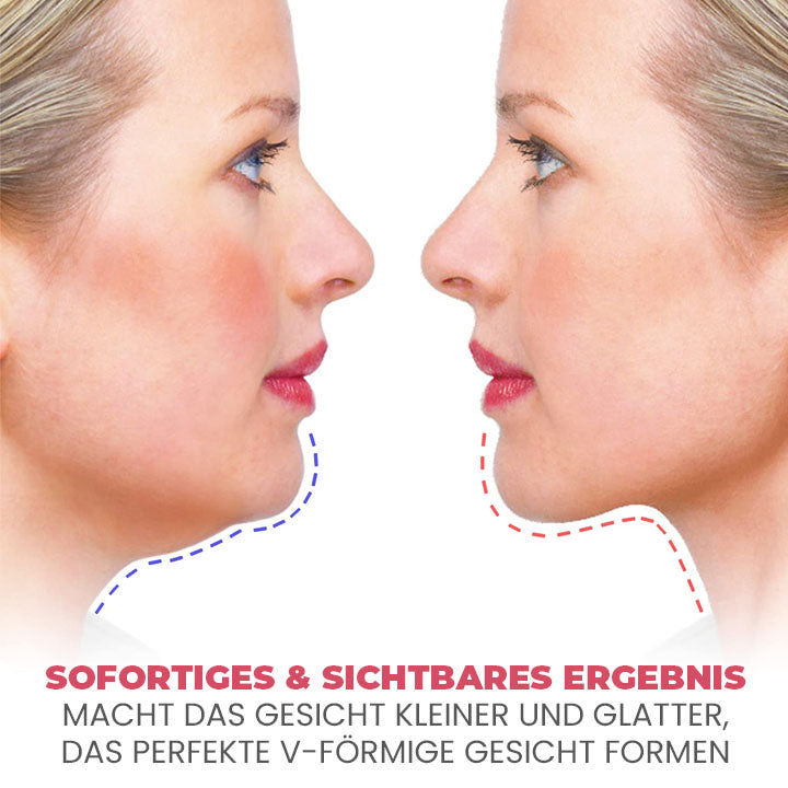 Oveallgo™ Doppelkinn-Entfernung V-Gesichts-Saugtrainer