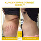 Oveallgo™ Profi Natürliches CelluPro-Körperöl