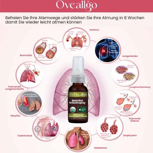 Oveallgo™ Natürliches X Kräuterspray zur Unterstützung von Lunge und Atemwegen