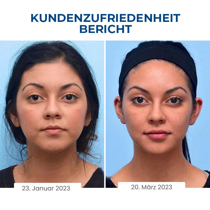 Oveallgo™ SleepBeauty Profi Gesichtsbildhauer