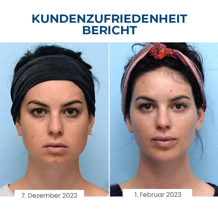 Oveallgo™ SleepBeauty PRO Gesichtsbildhauer