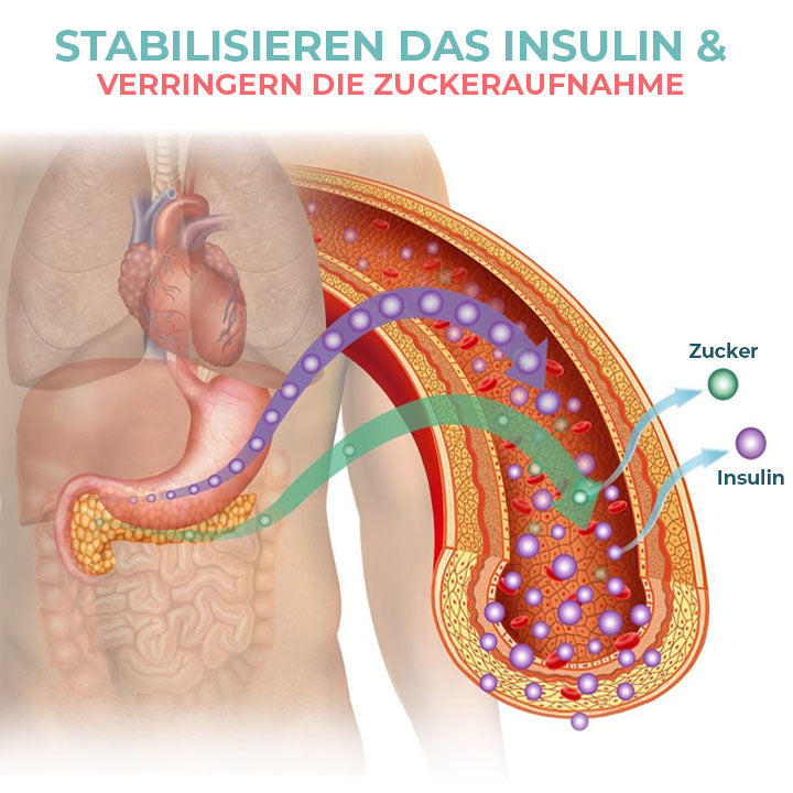 Oveallgo™ SugarFixed PLUS Ultraschall Verflüssigungs Handschlaufe