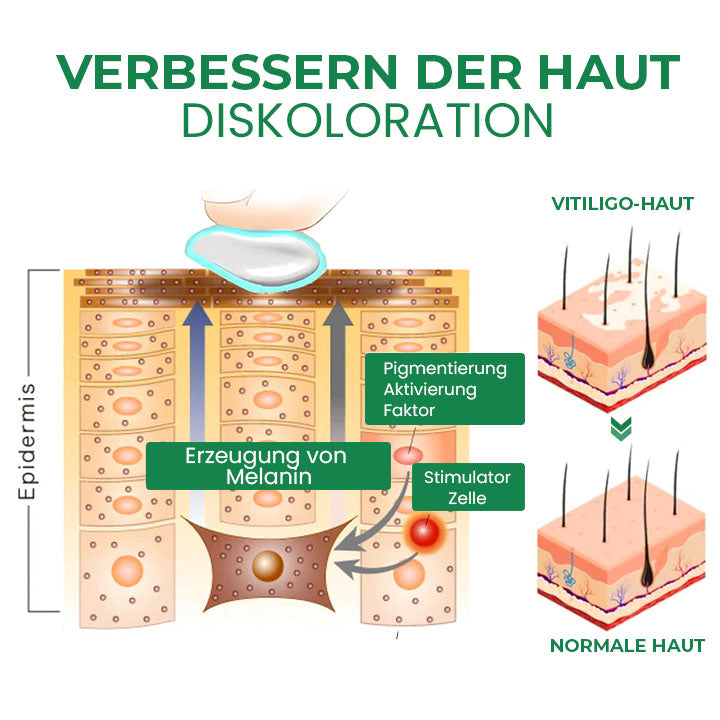 Oveallgo™ VitiligoFix Revitalisierendes Elixier