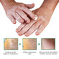 Oveallgo™ VitiligoFix X Revitalisierendes Elixier