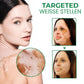 Oveallgo™ VitiligoFix X Revitalisierendes Elixier