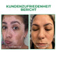 Oveallgo™ PRO VitiligoFix Revitalisierendes Elixier