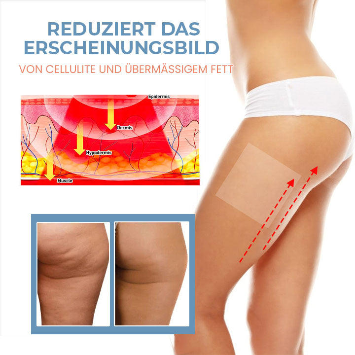 SilkenCell™ Kollagen Straffende Anti-Cellulite-Pflaster