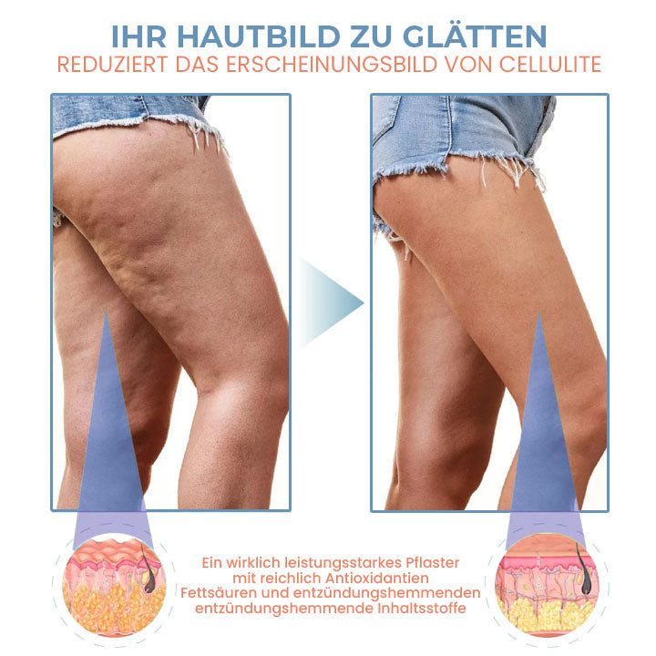 SilkenCell™ Kollagen Straffende Anti-Cellulite-Pflaster