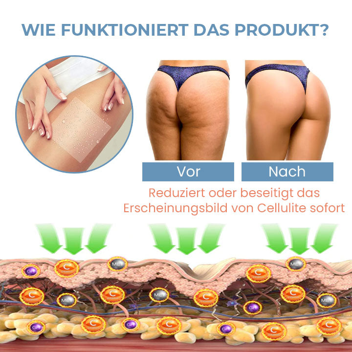 SilkenCell™ Kollagen Straffende Anti-Cellulite-Pflaster