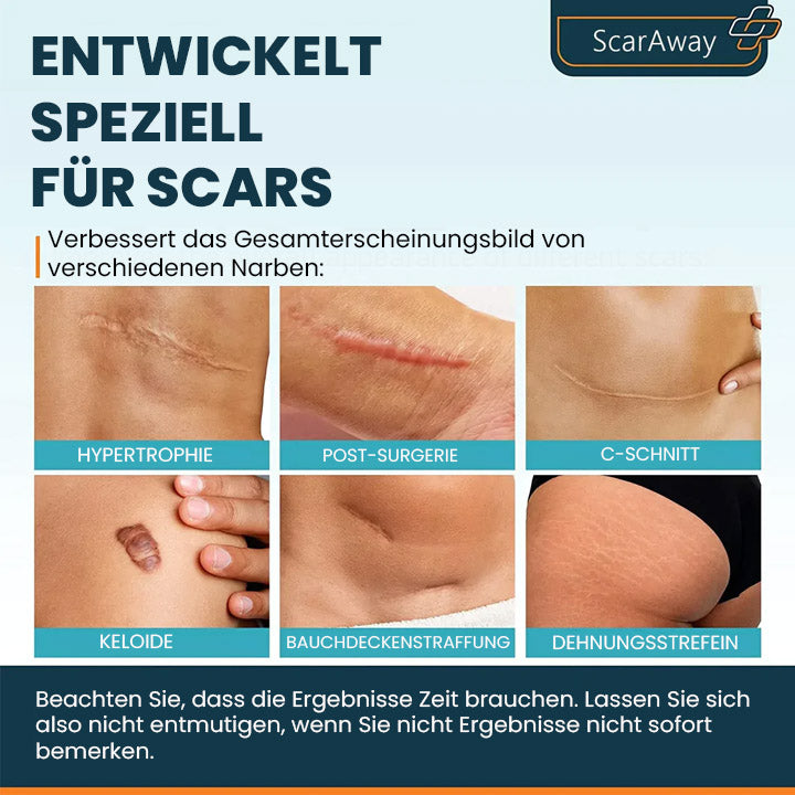 Thiccfitts™ ScarAway Fortschrittliches Narbengel - Kaiserschnitt, Bauchdeckenstraffung, alte Narben, Keloide, Dehnungsstreifen, Brandnarben