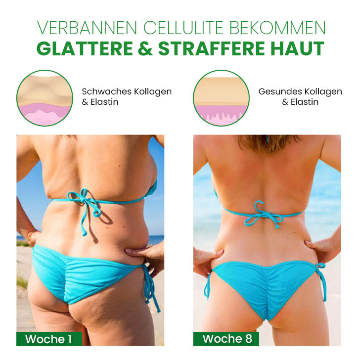 SusoSkin Profi 2-in-1-Kräuterbalsam zur Beruhigung von Cellulite