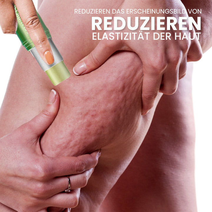 SusoSkin Profi 2-in-1-Kräuterbalsam zur Beruhigung von Cellulite