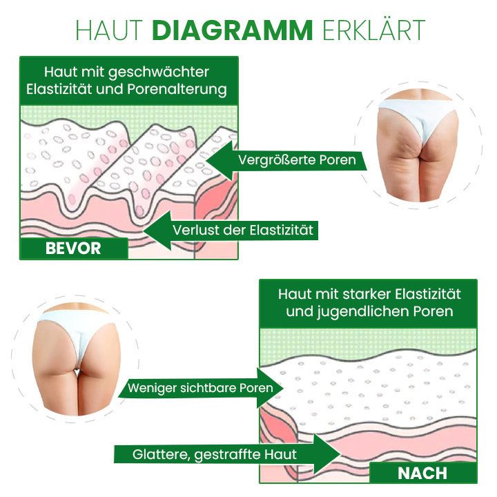 SusoSkin Profi 2-in-1-Kräuterbalsam zur Beruhigung von Cellulite