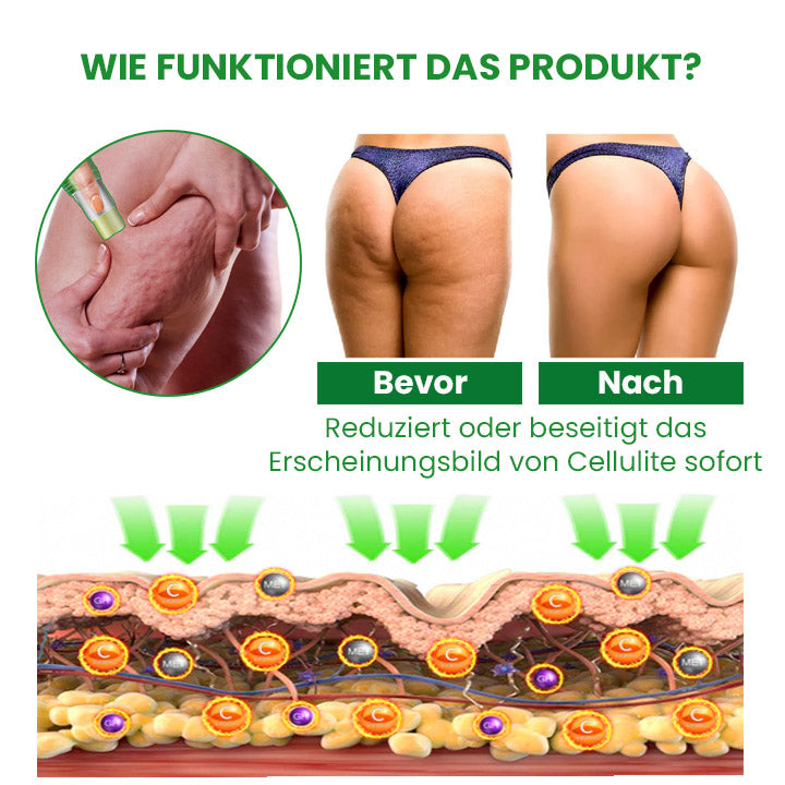 SusoSkin Profi 2-in-1-Kräuterbalsam zur Beruhigung von Cellulite