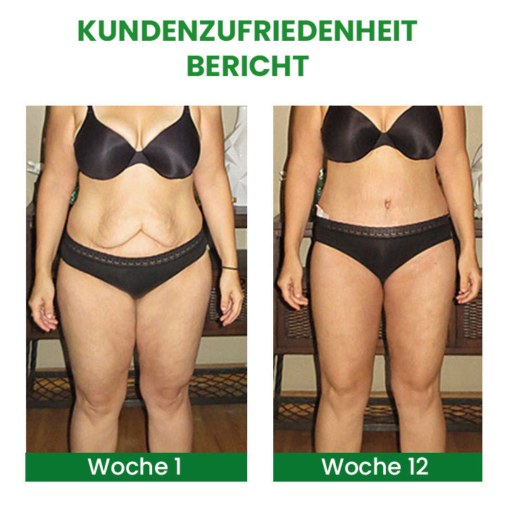 SusoSkin Profi 2-in-1-Kräuterbalsam zur Beruhigung von Cellulite