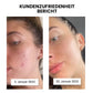 Thiccfitts™ Deluxe Silk Anti-Acne Kopfkissenbezug