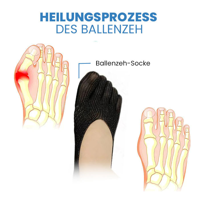 Wingle Profi Anti-Bunions Gesundheitssocke