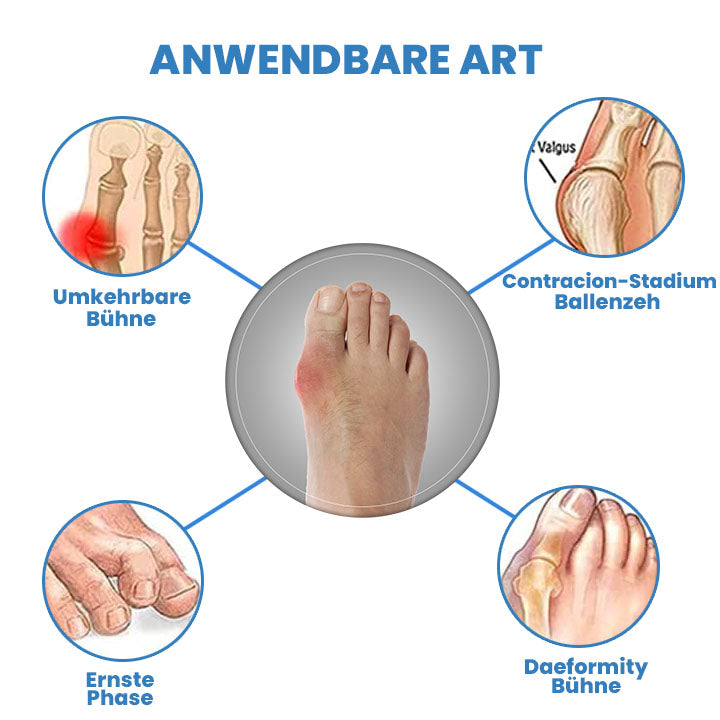 Wingle Profi Anti-Bunions Gesundheitssocke