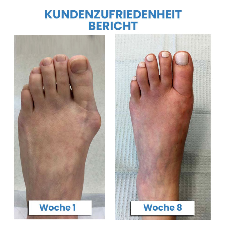 Wingle Profi Anti-Bunions Gesundheitssocke